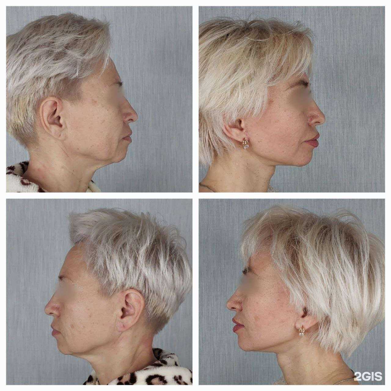 Отзывы на компанию Космо Пластик в г. Тверь c фото