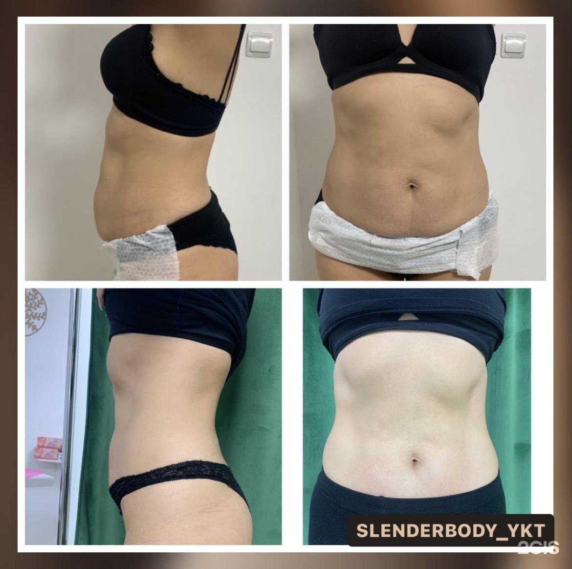 Отзывы на компанию Slender body в Якутске c фото