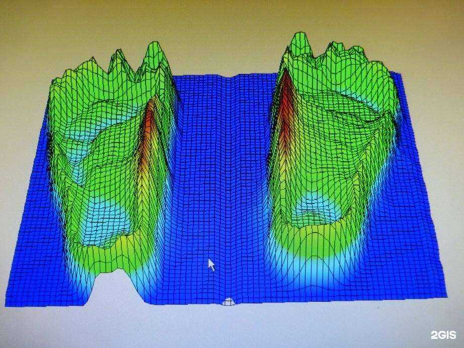 Отзывы на компанию Московское протезно-ортопедическое предприятие в Воронеже c фото