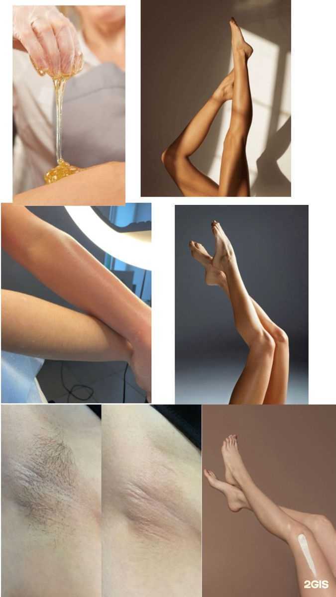 Отзывы на компанию Epillove в г. Краснодар c фото