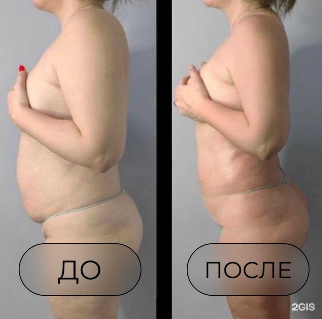 Отзывы на компанию Body El в г. Томск c фото