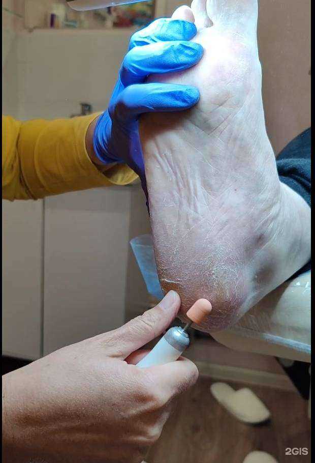 Отзывы на компанию Здоровые стопы в г. Архангельск c фото