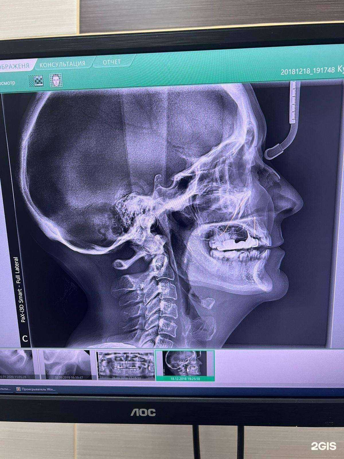 Отзывы на компанию ИмплантАВ в Стерлитамаке c фото