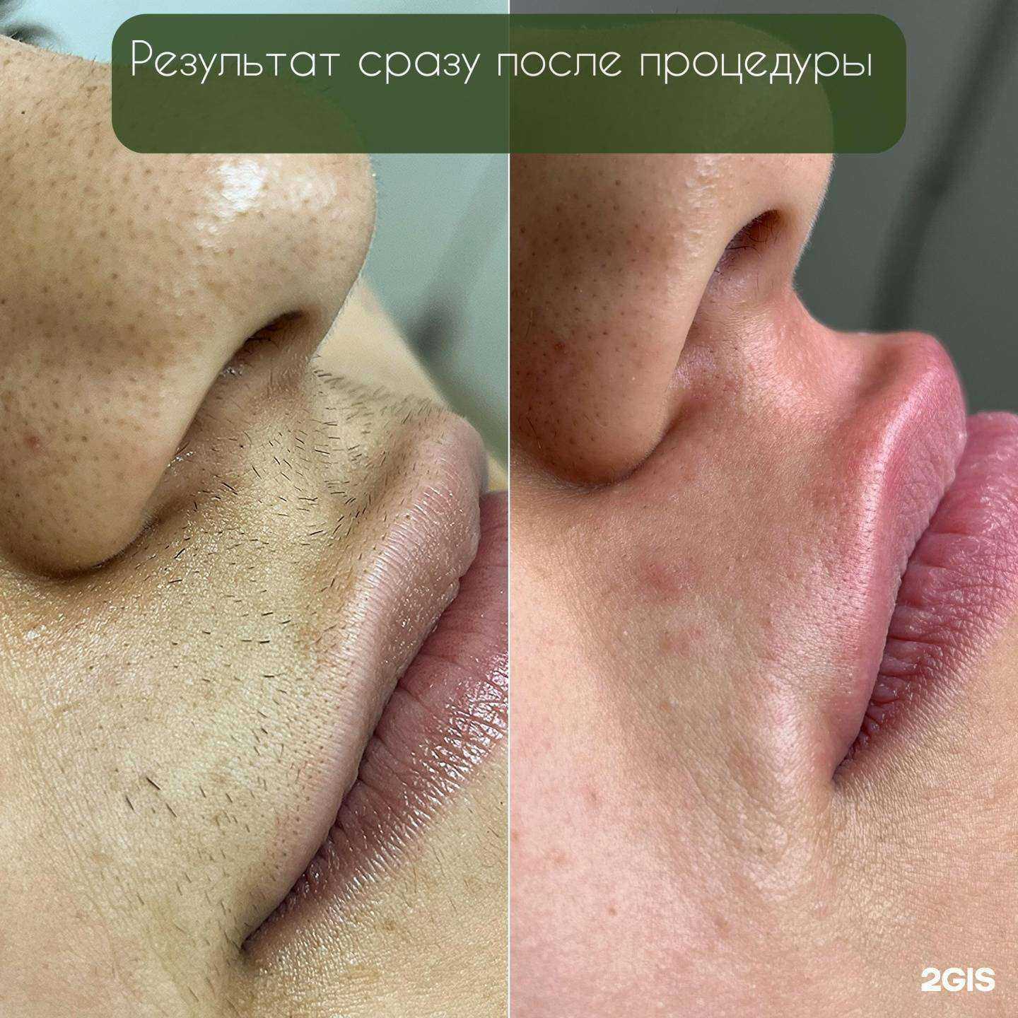 Отзывы на компанию Golden Wax в Белгороде c фото