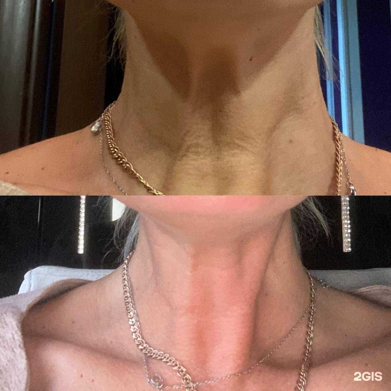 Отзывы на компанию Альфа Эстетика в Новосибирске c фото