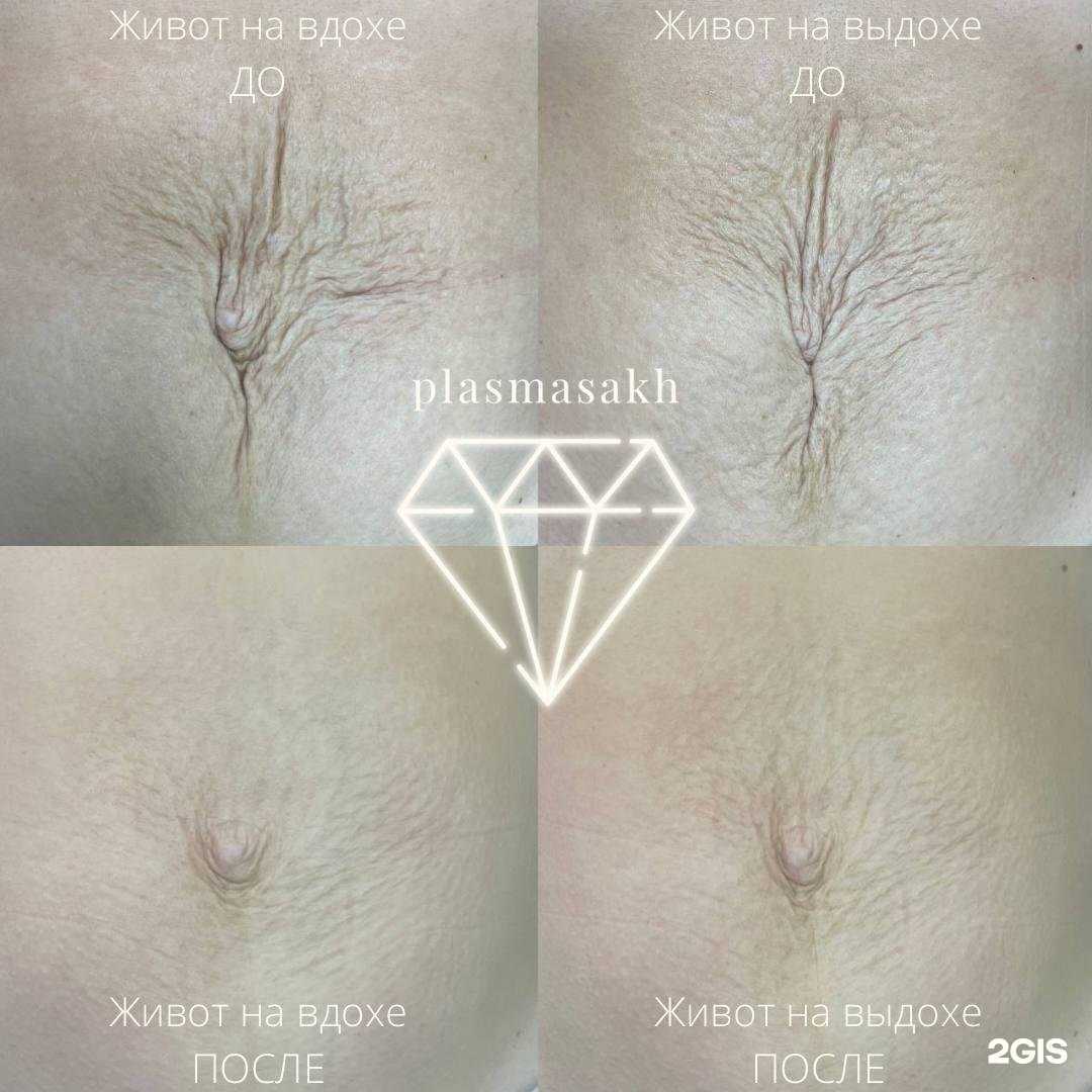 Отзывы на компанию Plasmasakh в Южно-Сахалинске c фото