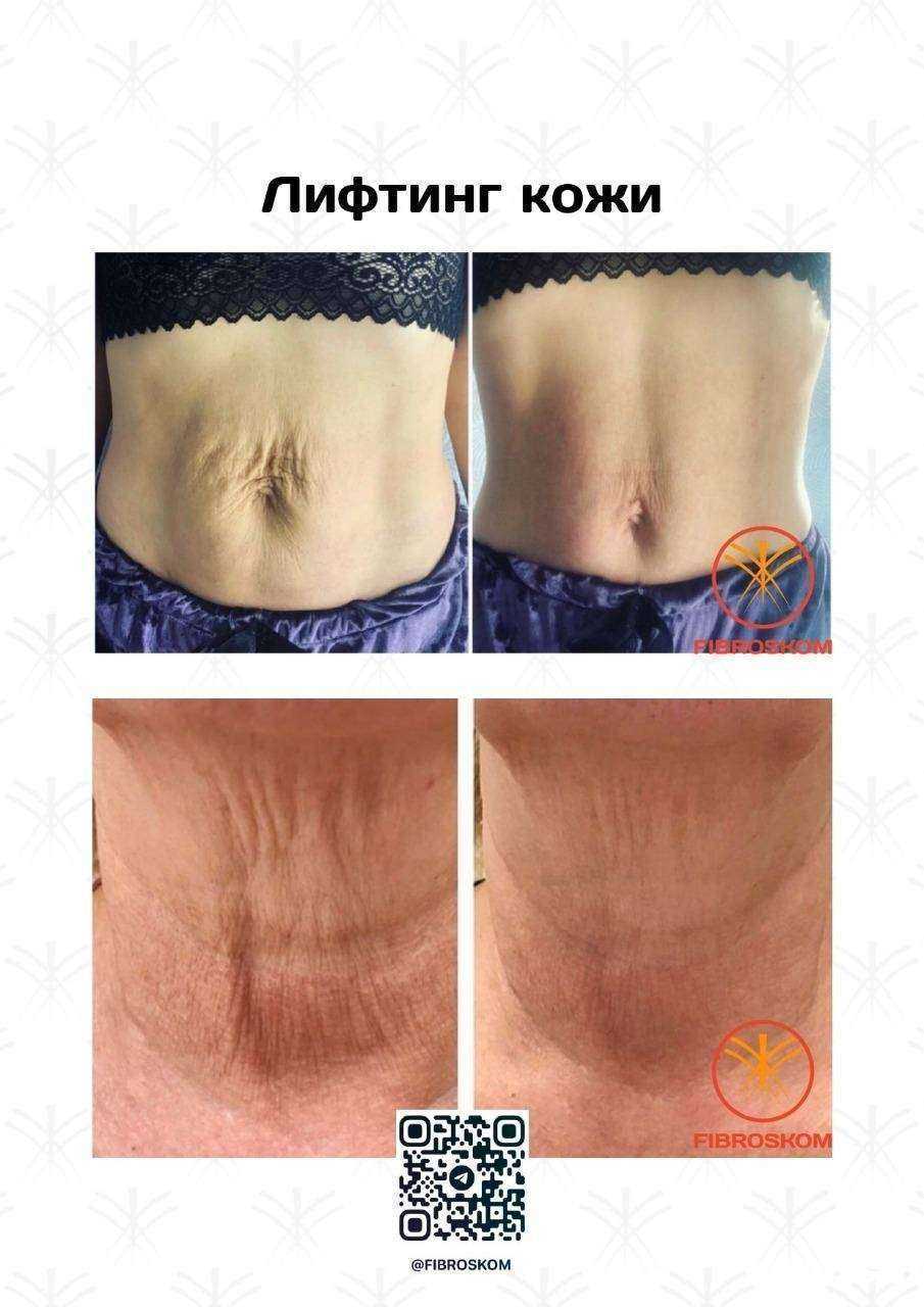 Отзывы на компанию Alena Khizhuk PRO.Молодость в г. Ноябрьск c фото