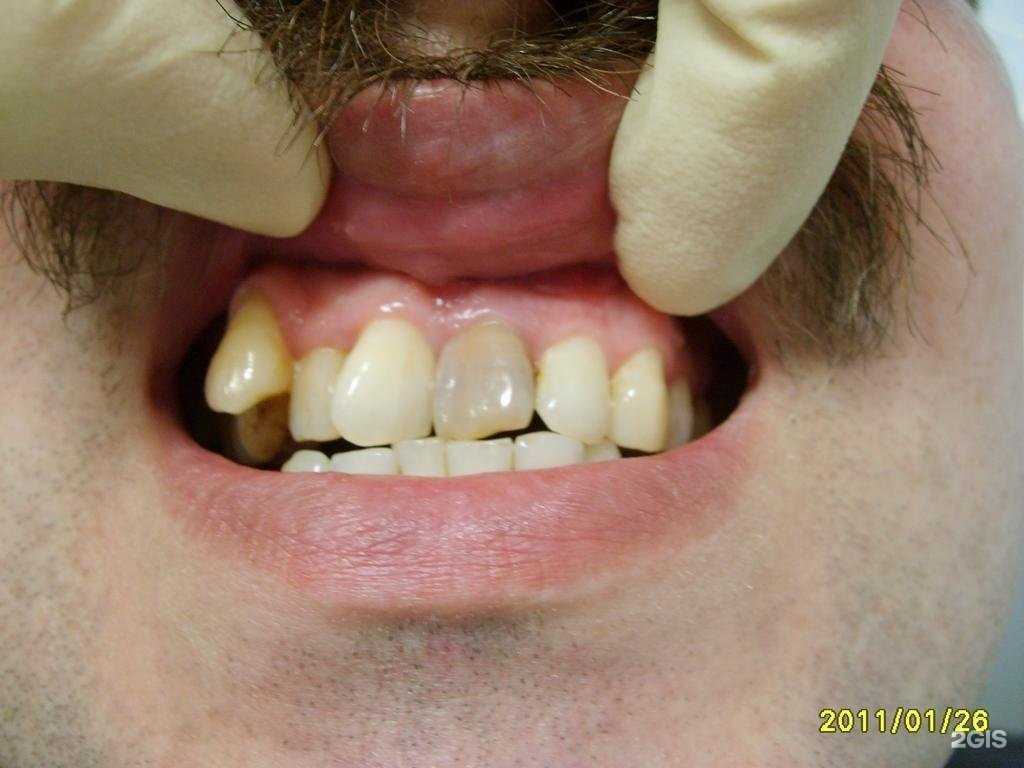 Отзывы на компанию Дента+ в г. Глазов c фото