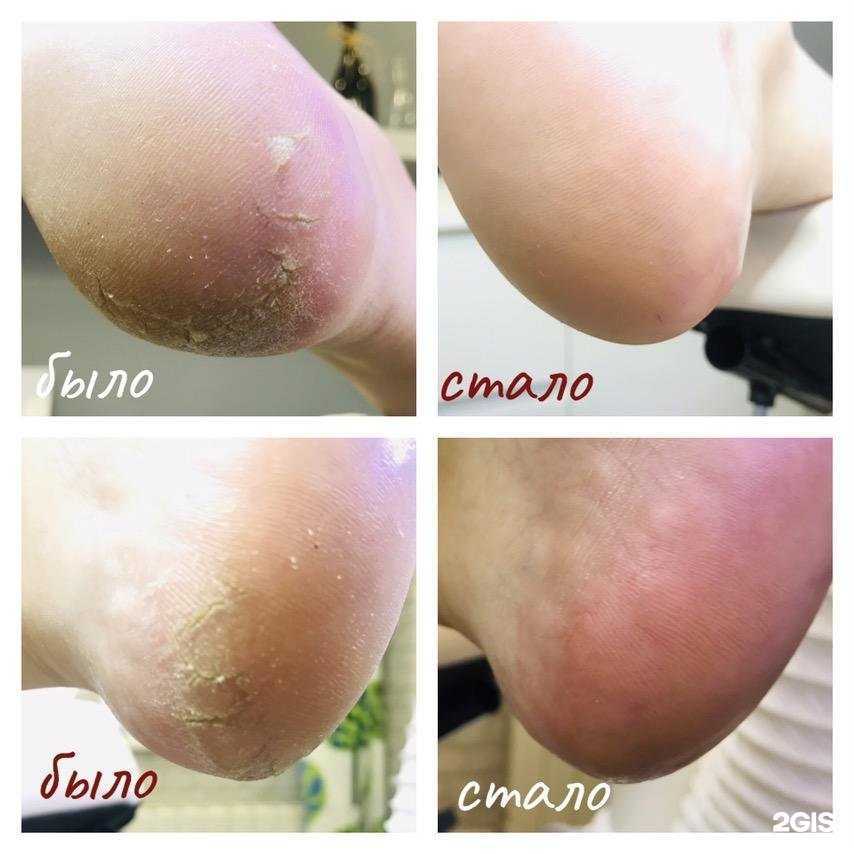 Отзывы на компанию Кабинет немецкой подологии в г. Пермь c фото