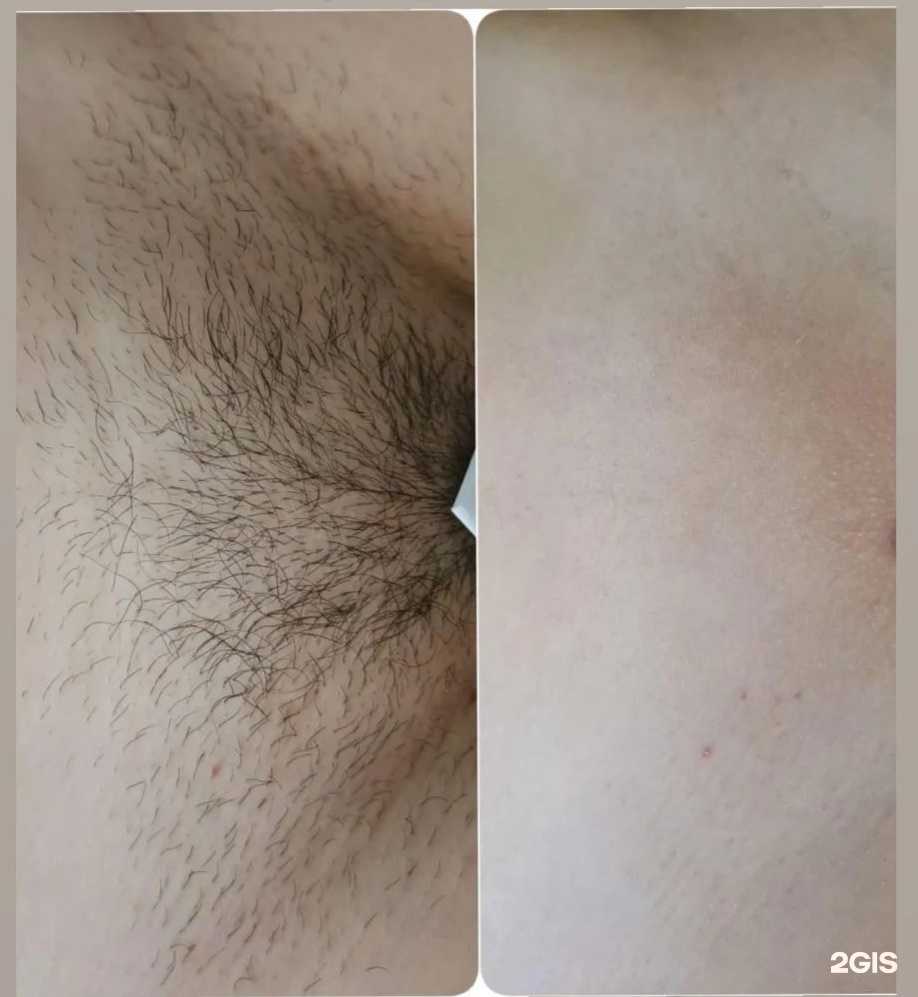 Отзывы на компанию Shugari_gel в Геленджике c фото