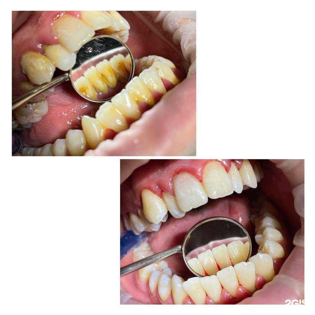 Отзывы на компанию Денталь в Махачкале c фото