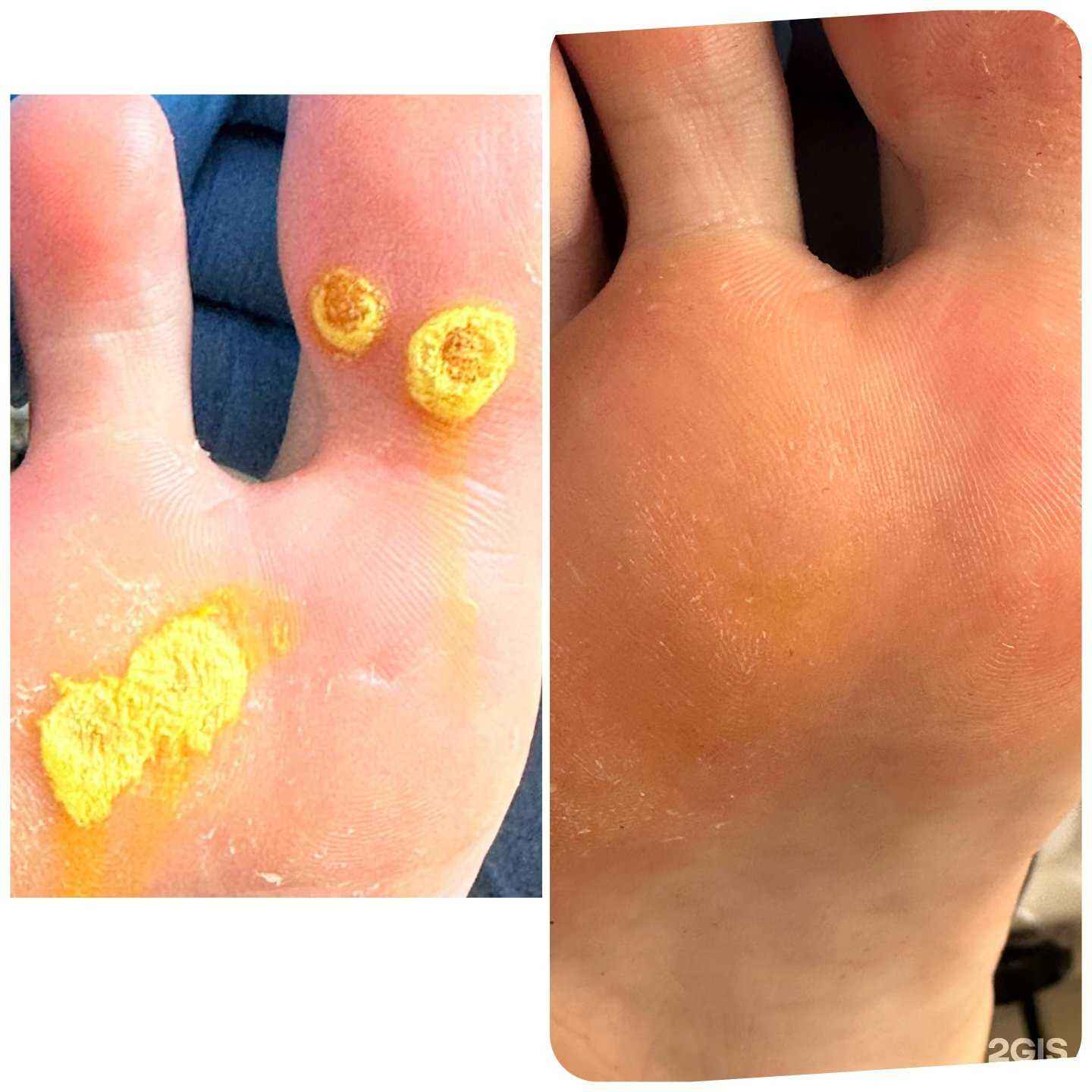 Отзывы на компанию Студия подологии в Калуге c фото