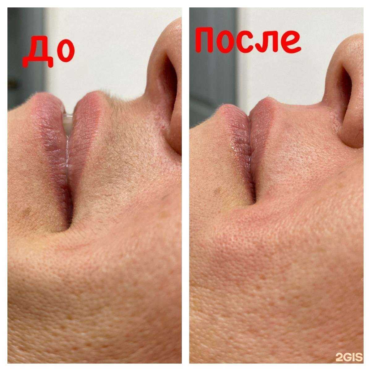 Отзывы на компанию Студия депиляции, коррекции фигуры и массажа в г. Пермь c фото