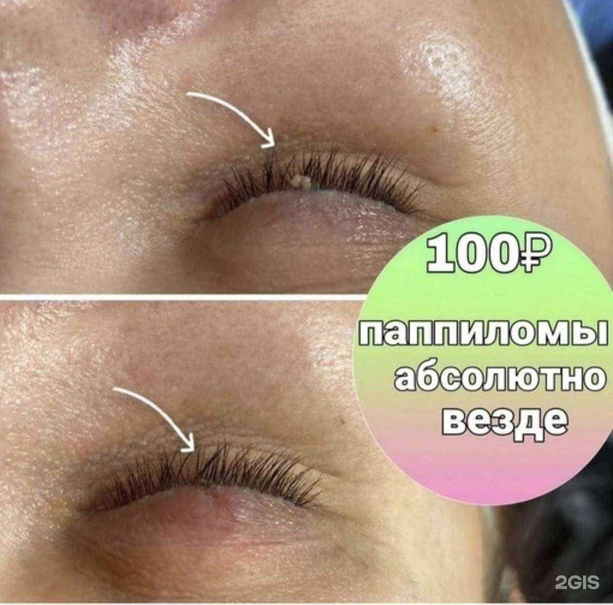 Отзывы на компанию Холодная плазма  в Кемерове c фото