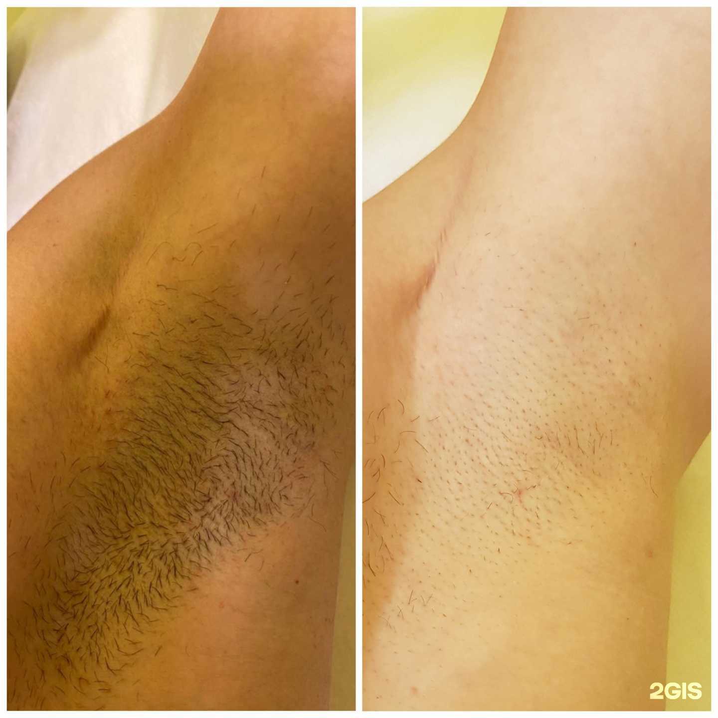 Отзывы на компанию Mindal в Брянске c фото