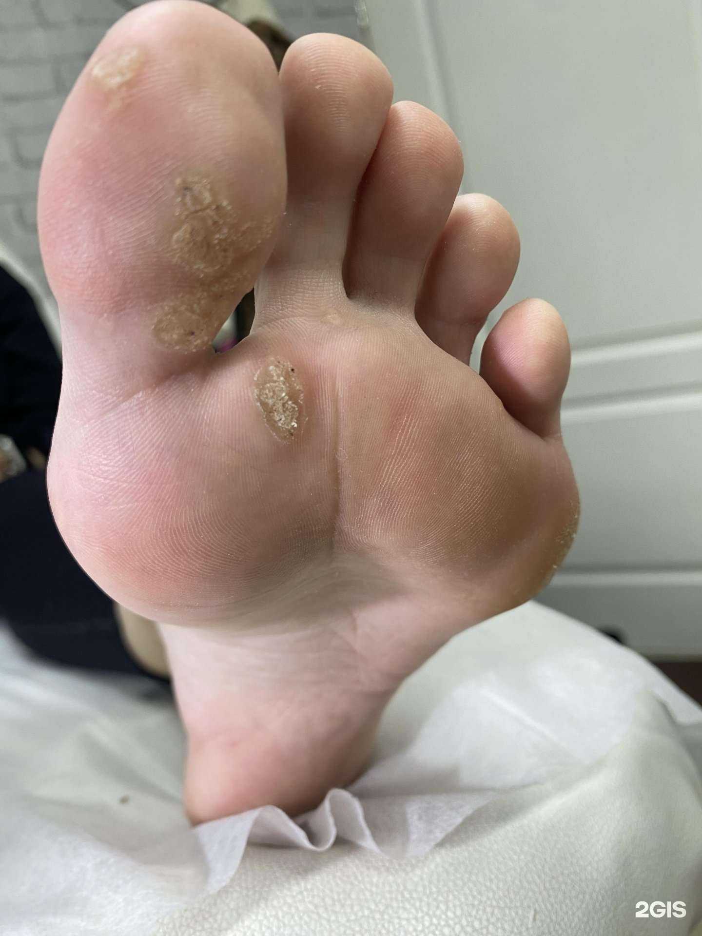 Отзывы на компанию Foot Medi в г. Абакан c фото