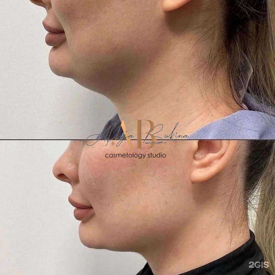 Отзывы на компанию Студия косметологии в Самаре c фото