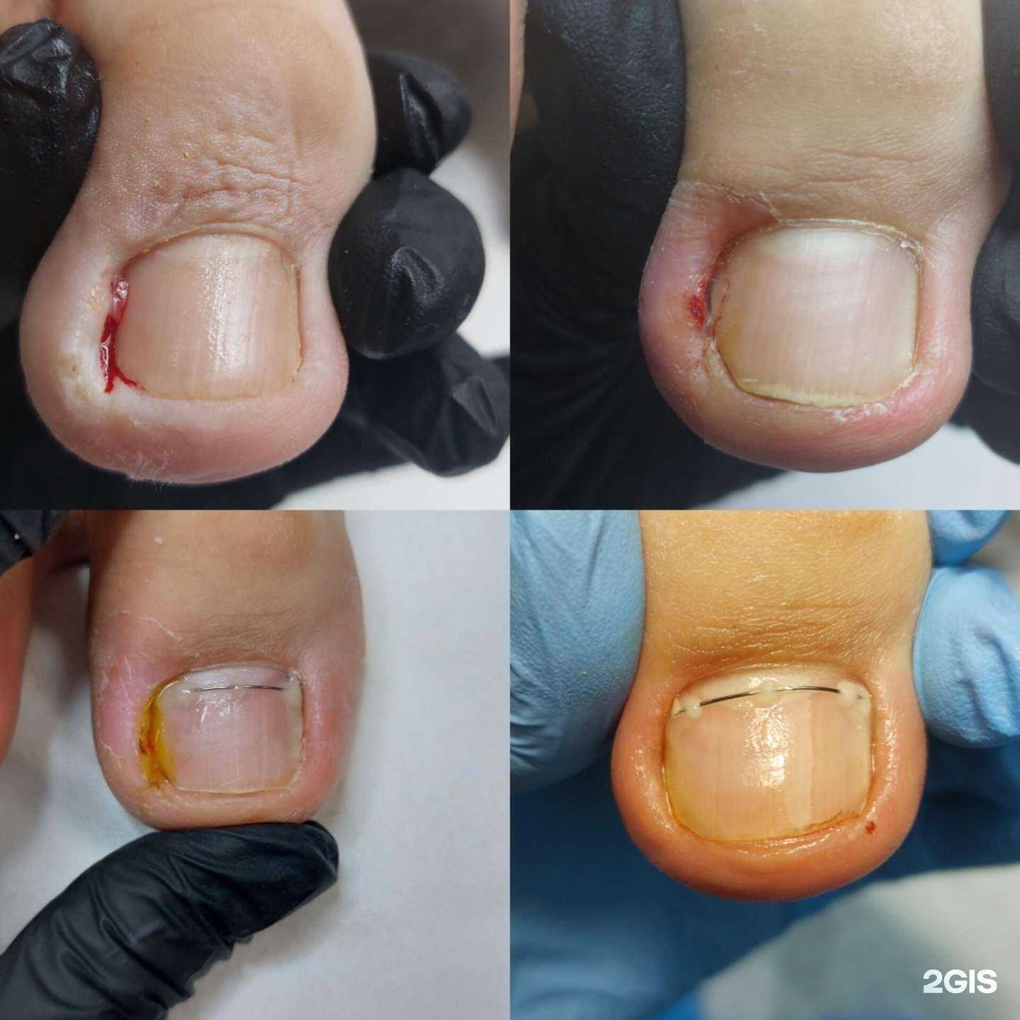 Отзывы на компанию Кабинет современного педикюра и подологии в г. Минусинск c фото