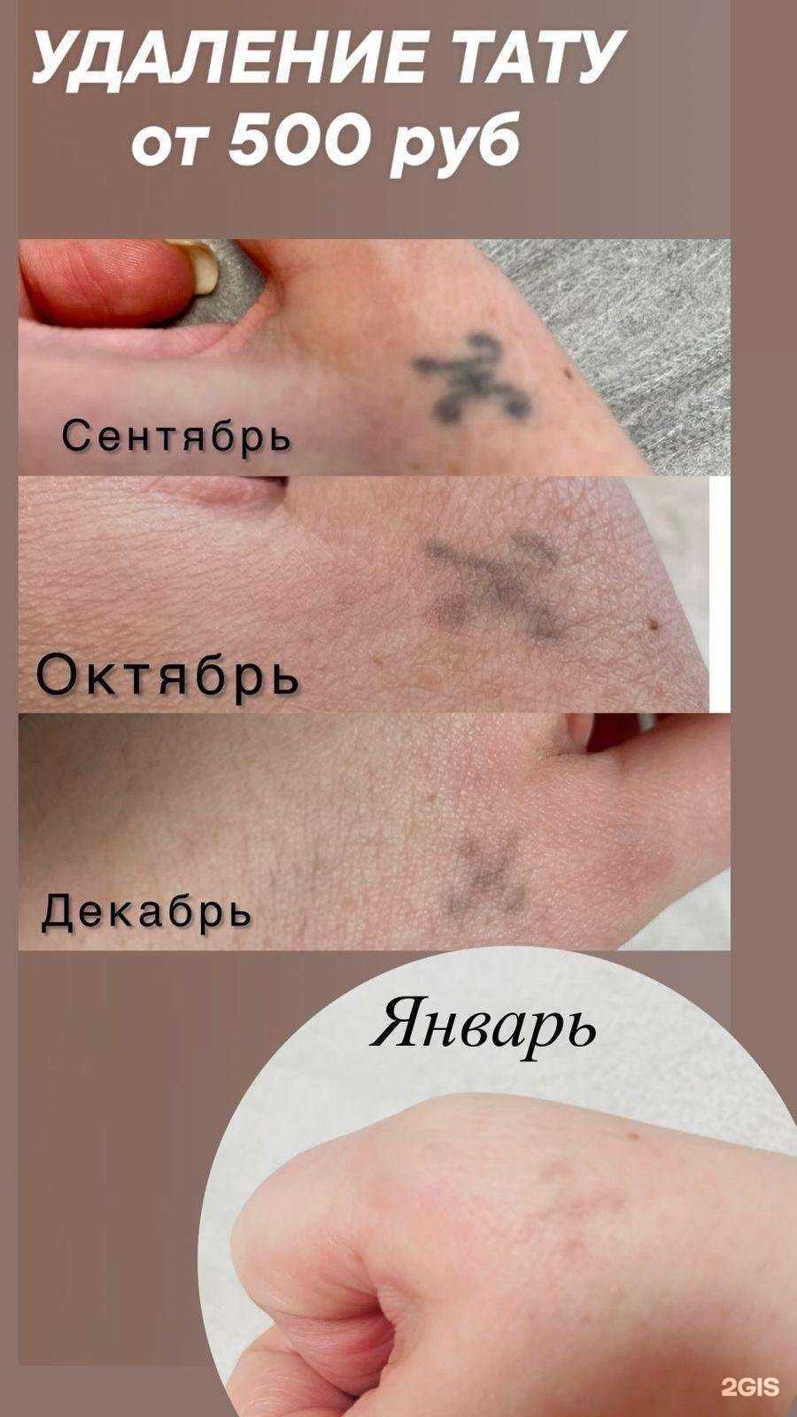 Отзывы на компанию Lazer.sunny в Екатеринбурге c фото