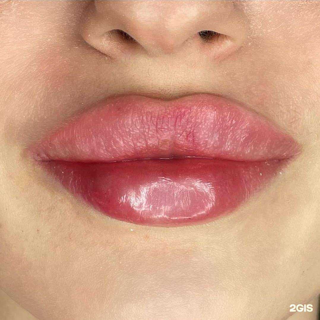 Отзывы на компанию Кабинет инъекционной косметологии в Тюмени c фото