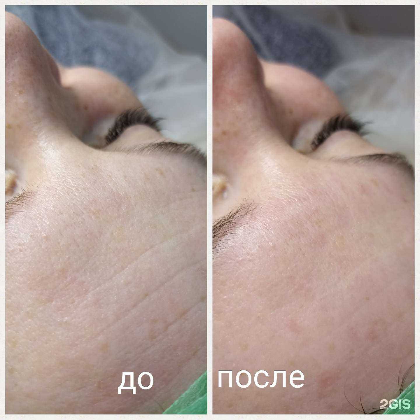 Отзывы на компанию ТриЛика в Ростове-на-Дону c фото