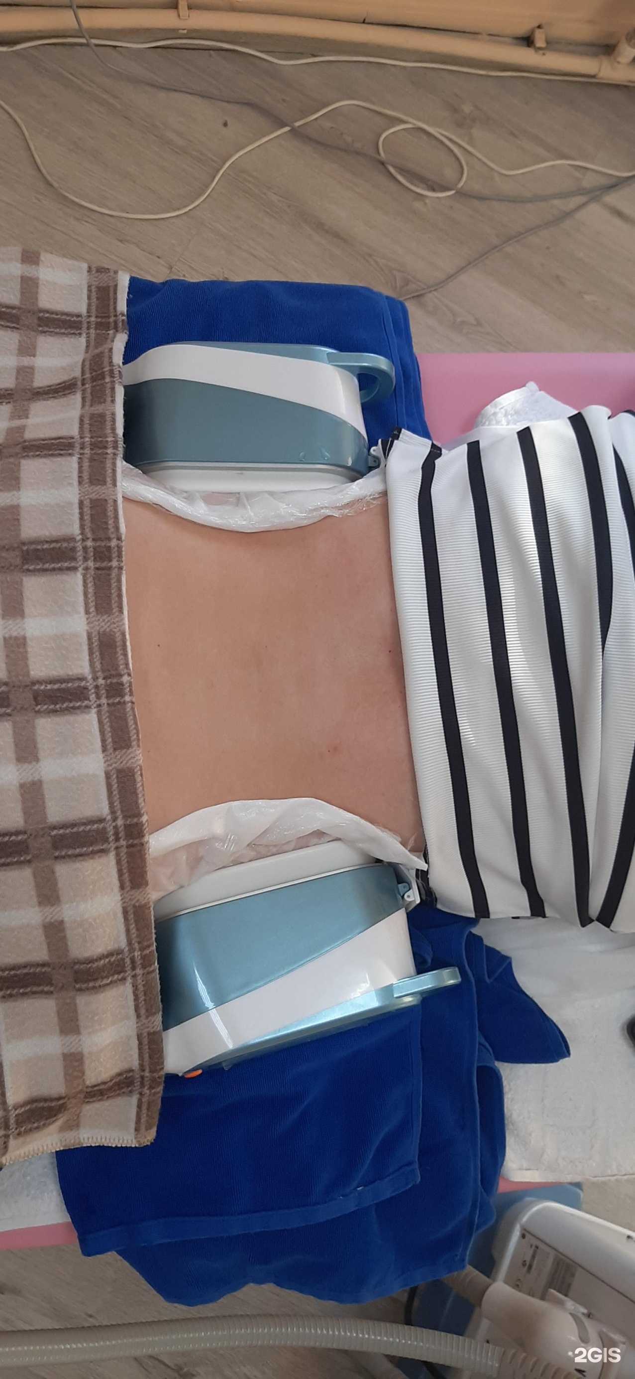 Отзывы на компанию Студия криолиполиза в Набережных Челнах c фото