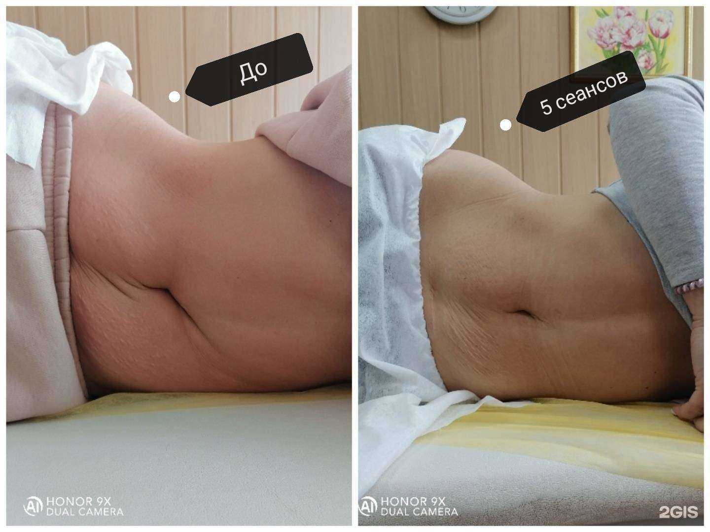 Отзывы на компанию Массажный кабинет Алексея Бизюкова в Сызрани c фото