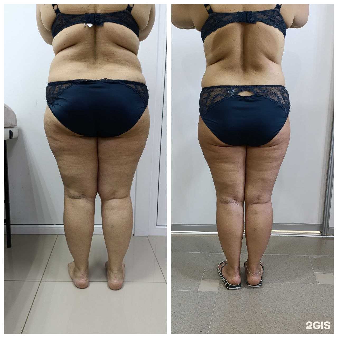 Отзывы на компанию Центр снижения веса и коррекции фигуры в Нижневартовске c фото