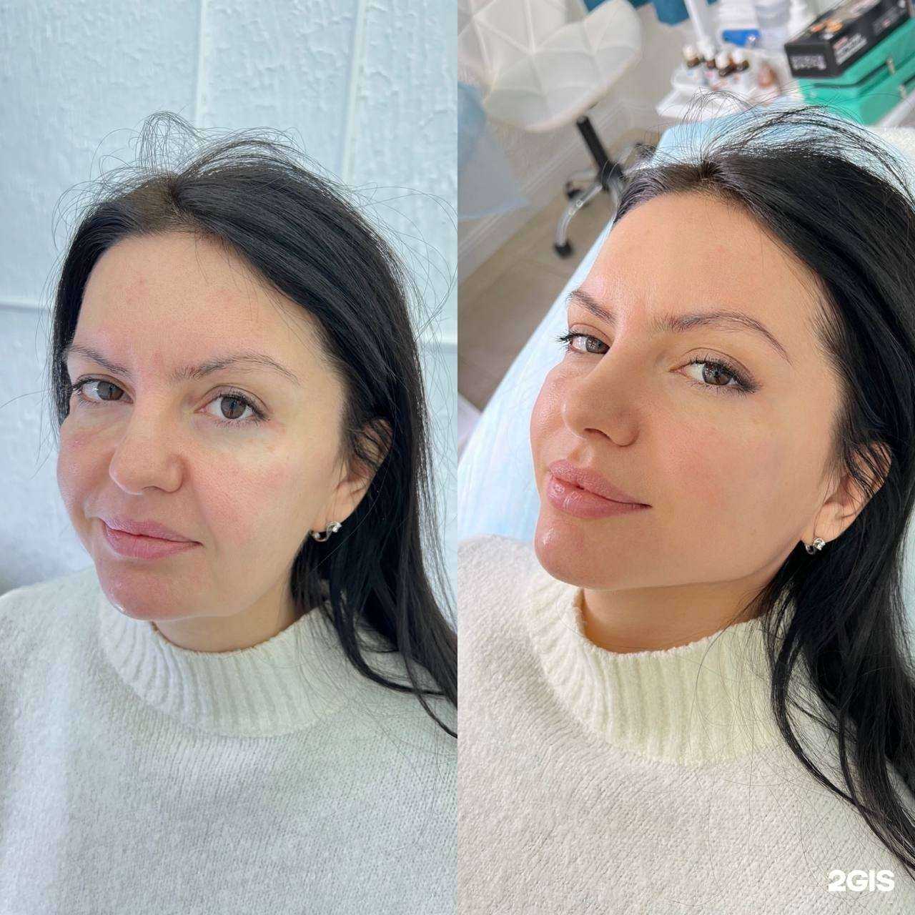 Отзывы на компанию Estetic_lab в Волгограде c фото