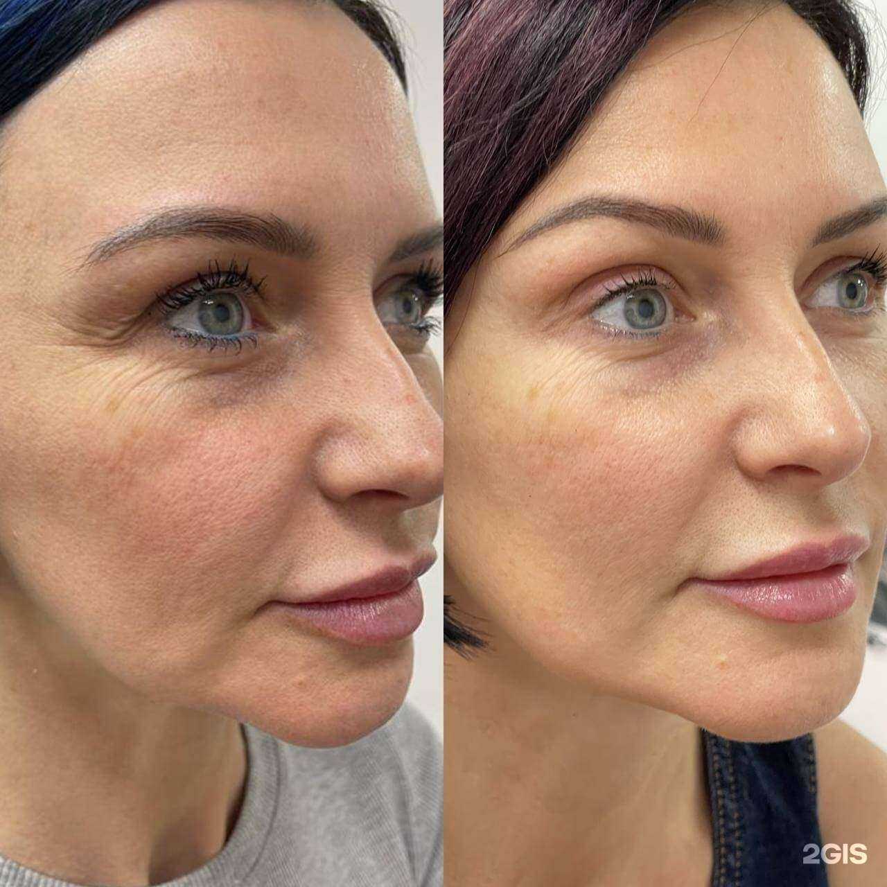 Отзывы на компанию Холодная плазма в г. Новый Уренгой c фото