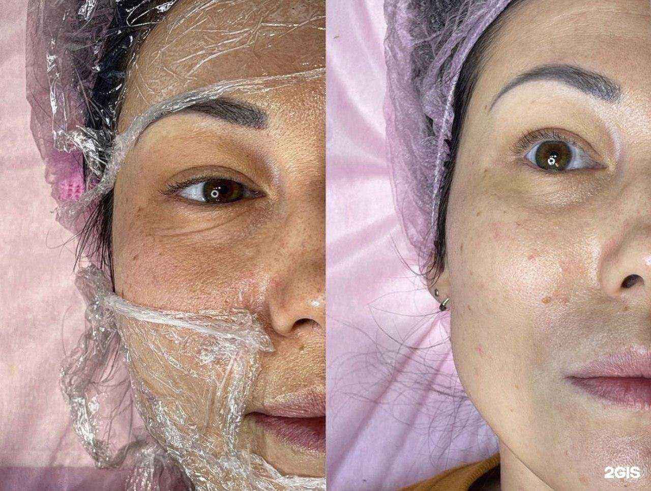 Отзывы на компанию Кабинет косметолога в Краснодаре c фото