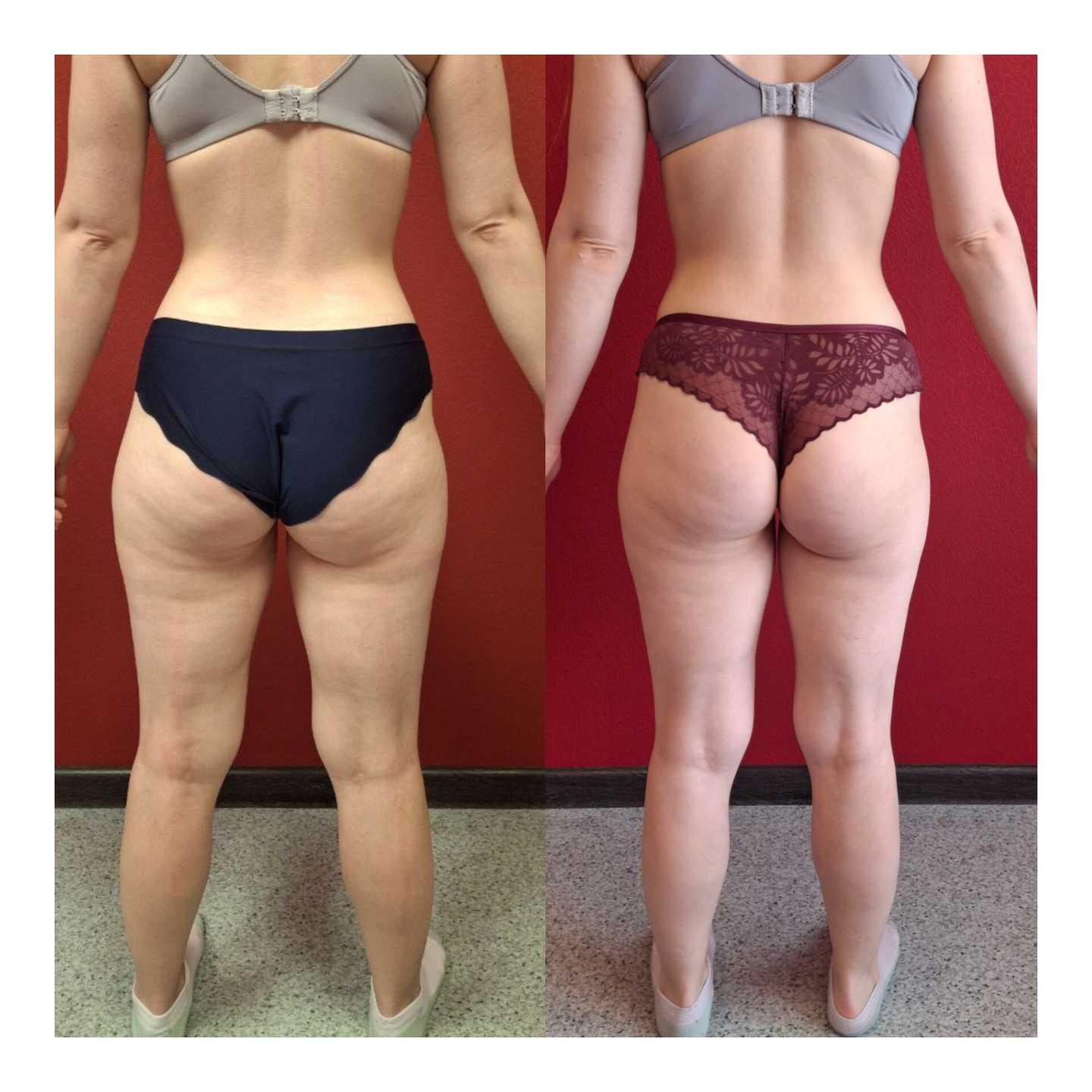 Отзывы на компанию Стройное тело в г. Новосибирск c фото