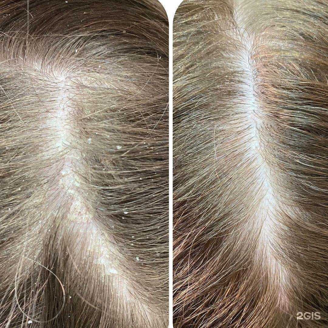 Отзывы на компанию Hair therapy в Петропавловске-Камчатском c фото