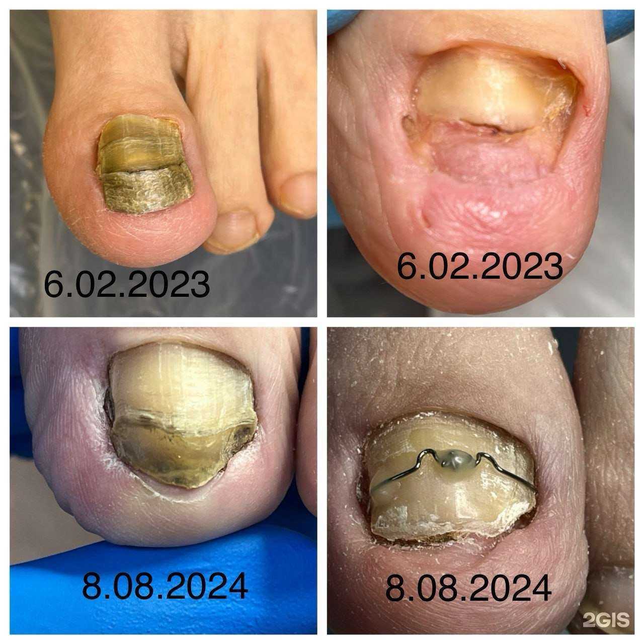 Отзывы на компанию Центр подологии Натальи Шустовой в г. Чита c фото