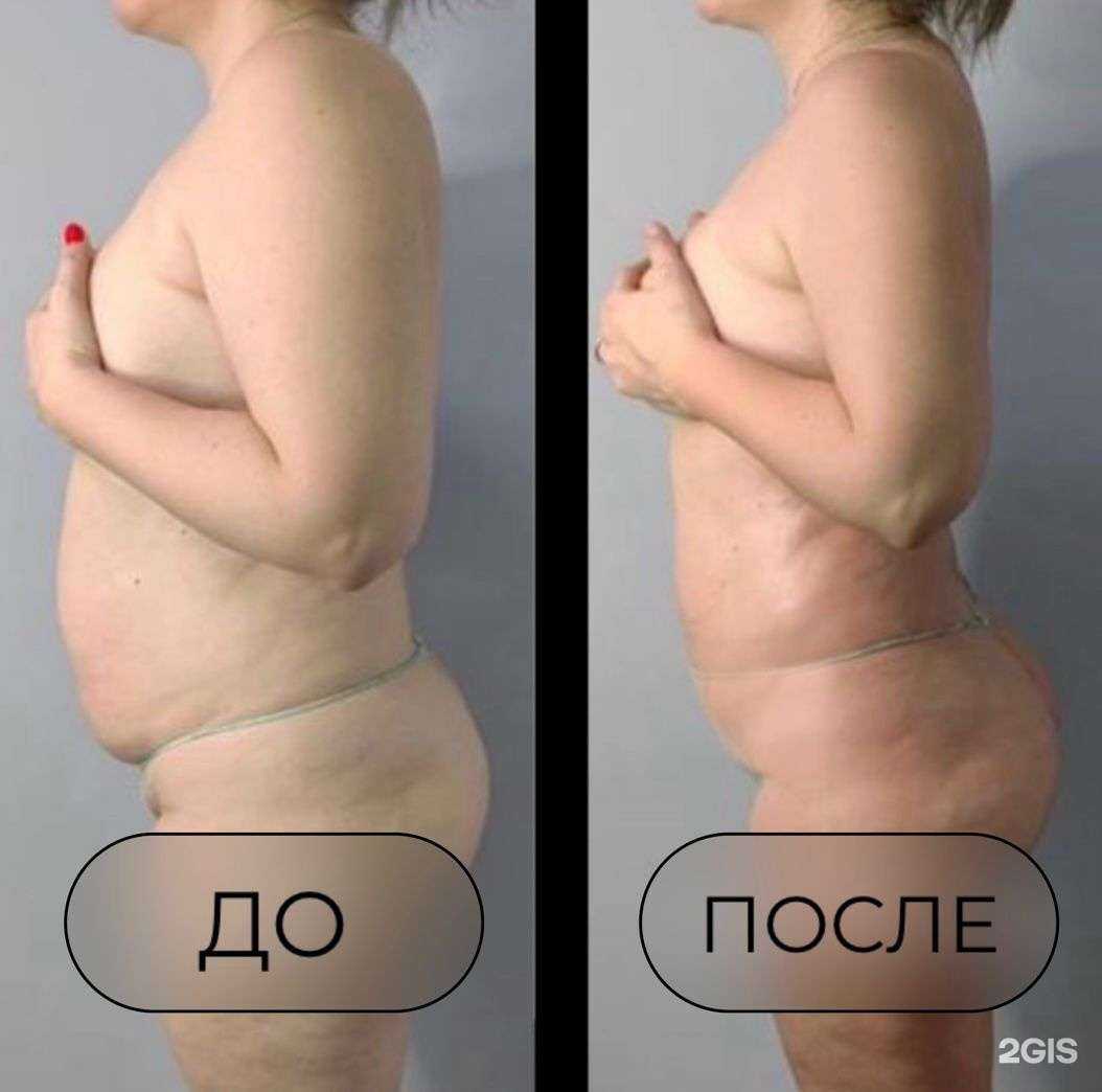 Отзывы на компанию Body El в Томске c фото
