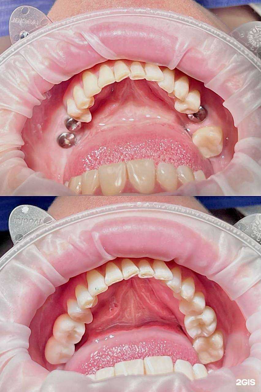 Отзывы на компанию EuroSmile в Челябинске c фото