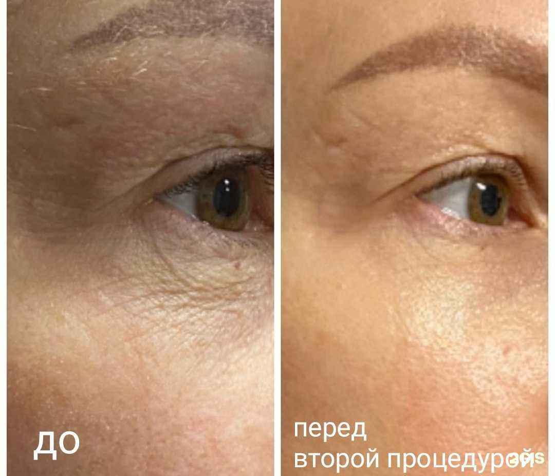 Отзывы на компанию Pro Тело в Перми c фото