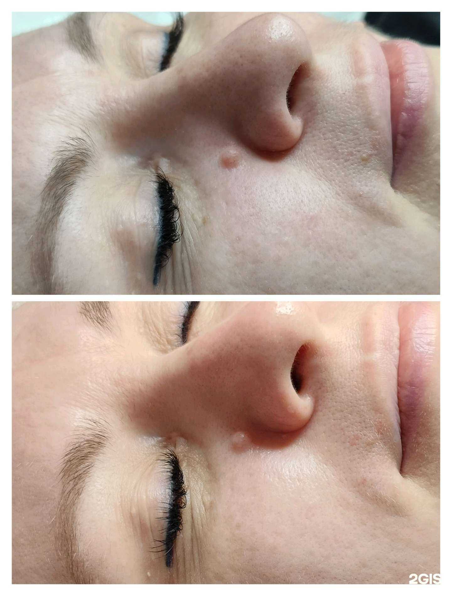 Отзывы на компанию Beautyepil_74 в Челябинске c фото