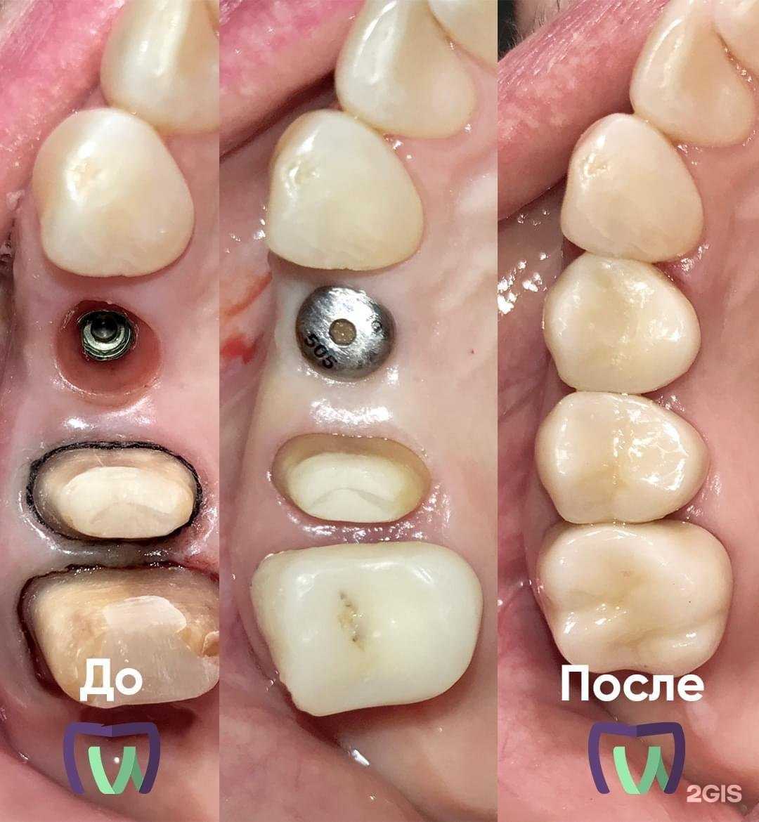 Отзывы на компанию Профессионал Имплант в г. Пенза c фото