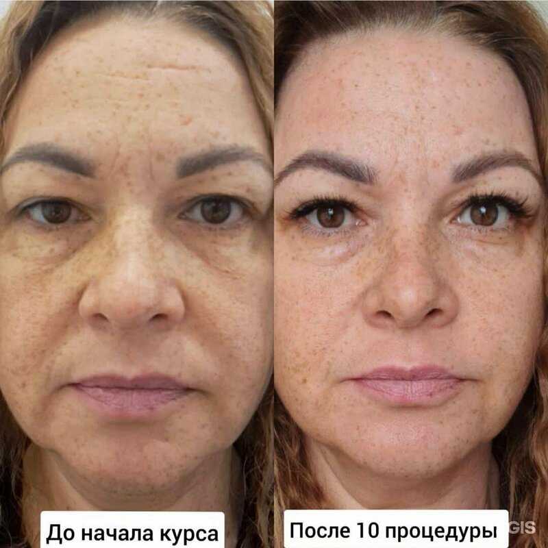 Отзывы на компанию Холодная plazma в Хабаровске c фото