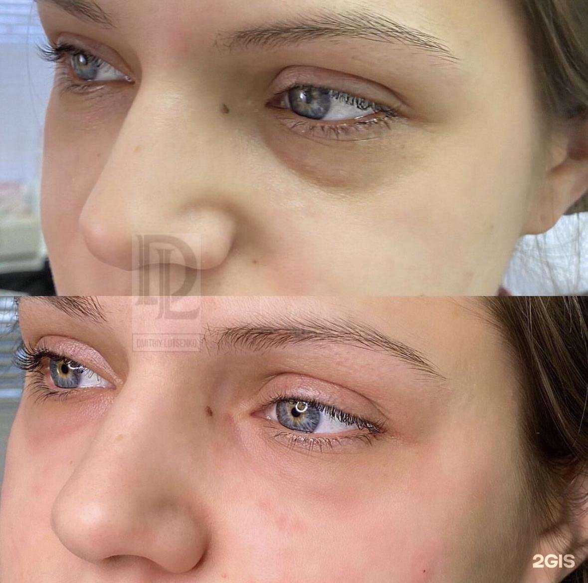 Отзывы на компанию @lutsenko_cosmetolog в г. Нижний Тагил c фото