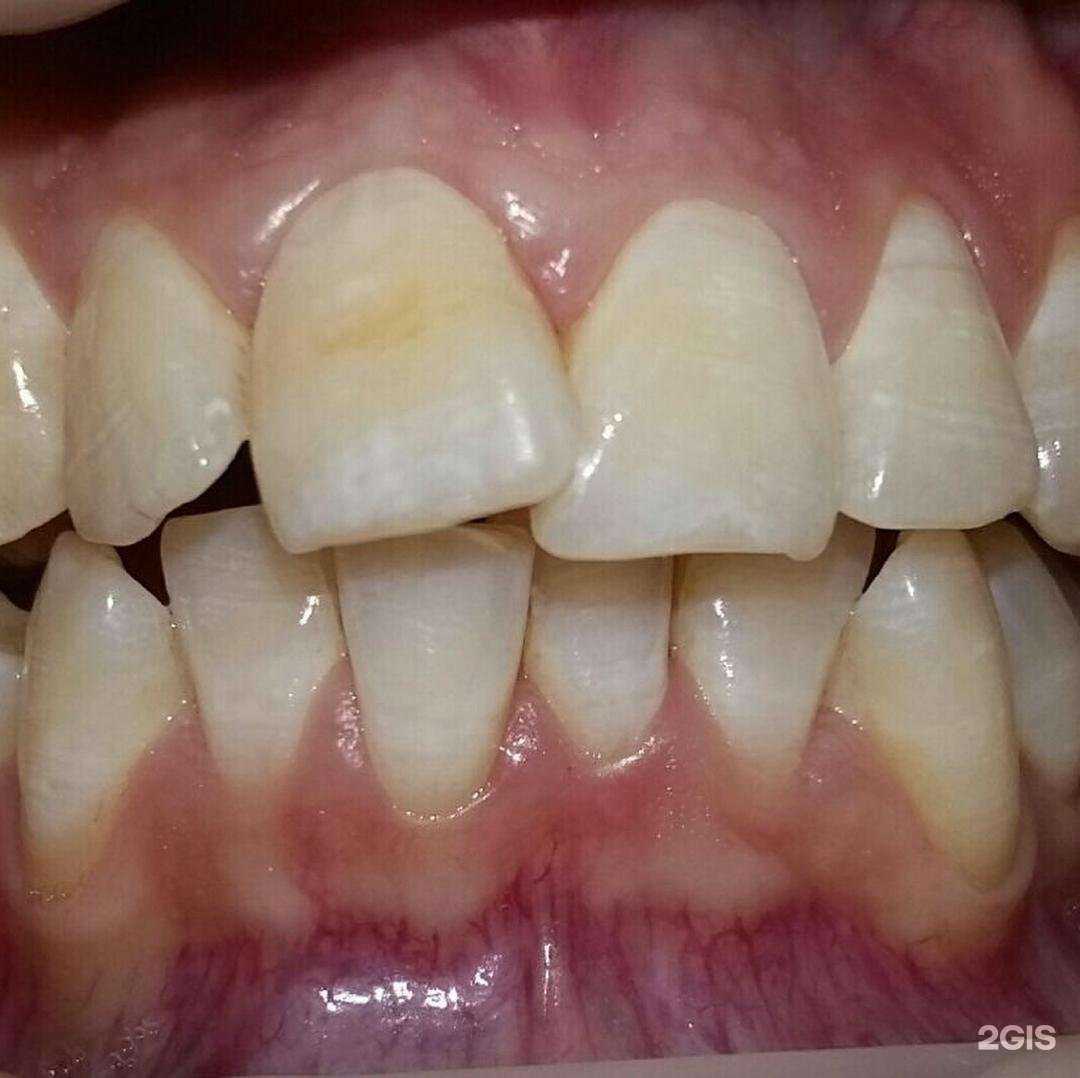 Отзывы на компанию Стоматологическая студия доктора Захарова в Набережных Челнах c фото