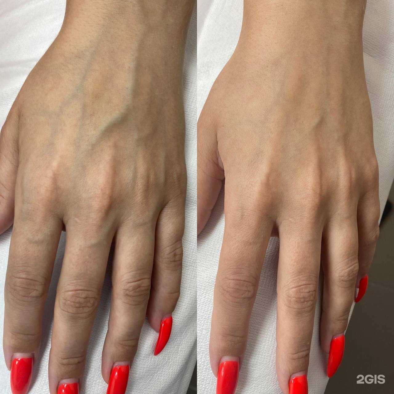 Отзывы на компанию Студия депиляции и эстетики тела в Саранске c фото