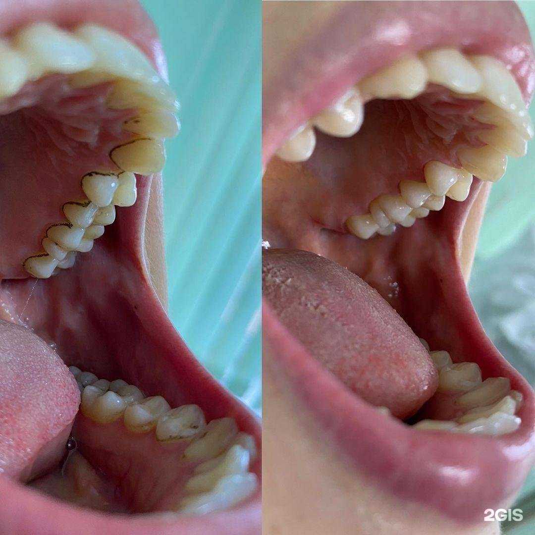 Отзывы на компанию Стоматологический кабинет Муратова Р.И. в Крымске c фото