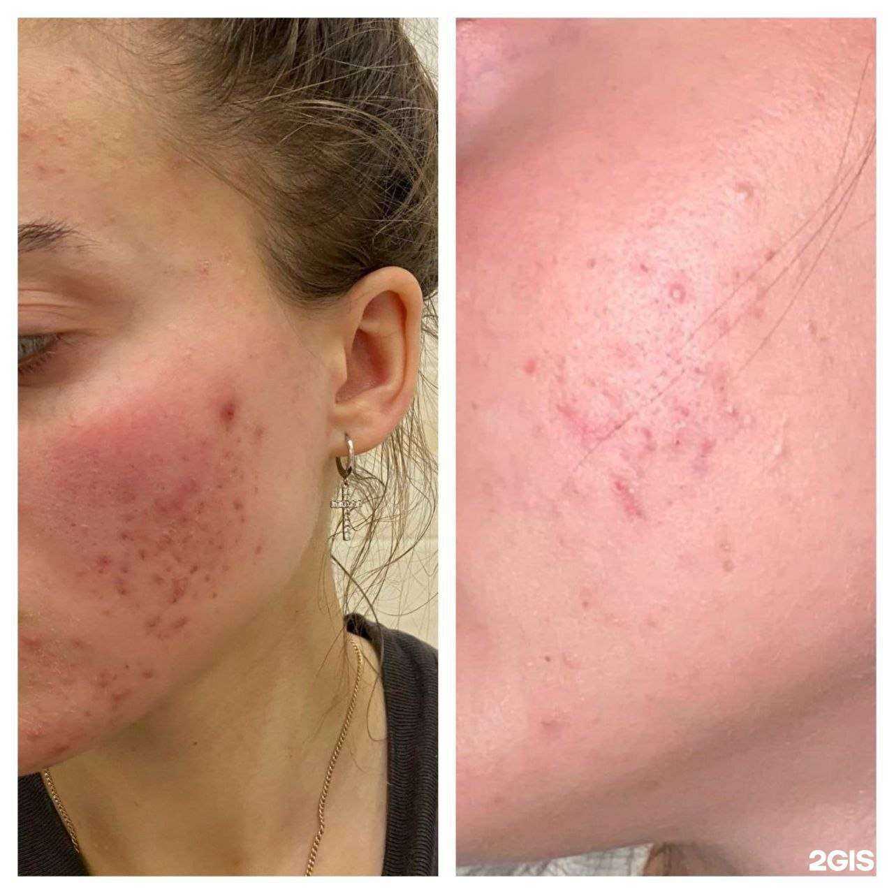 Отзывы на компанию Кабинет косметолога-эстетиста в Екатеринбурге c фото