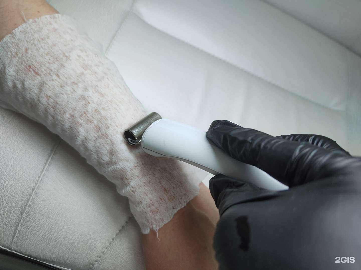 Отзывы на компанию Флокс.epil в Екатеринбурге c фото