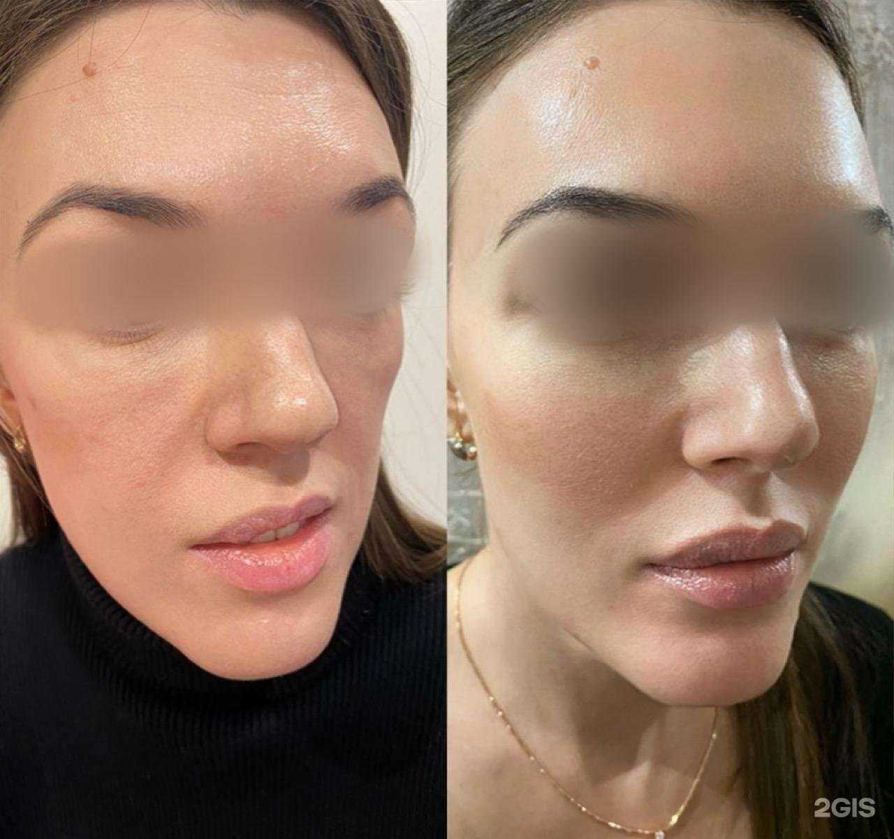 Отзывы на компанию Косметология Кристины Сидоренко в Краснодаре c фото