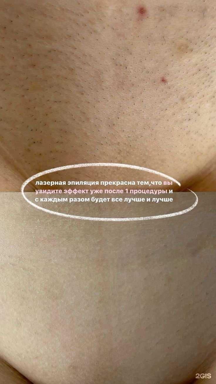 Отзывы на компанию Vip_laser_uss в г. Уссурийск c фото