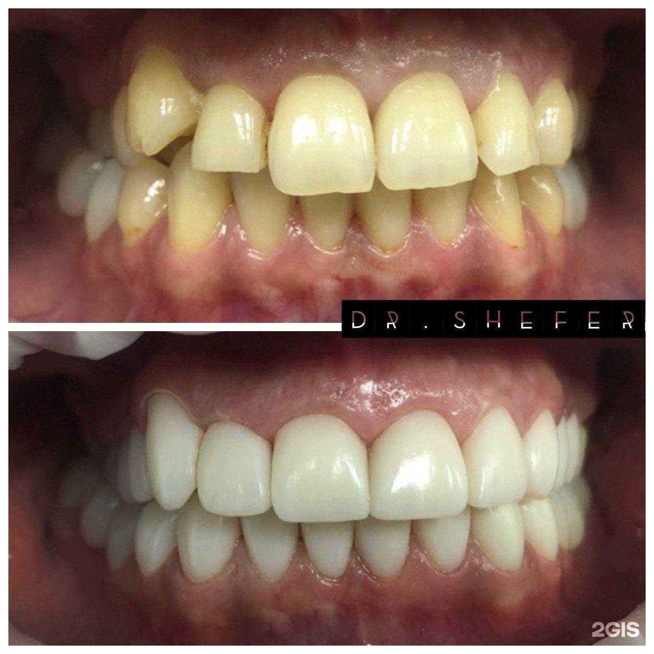 Отзывы на компанию Доктор Шефер в г. Иркутск c фото