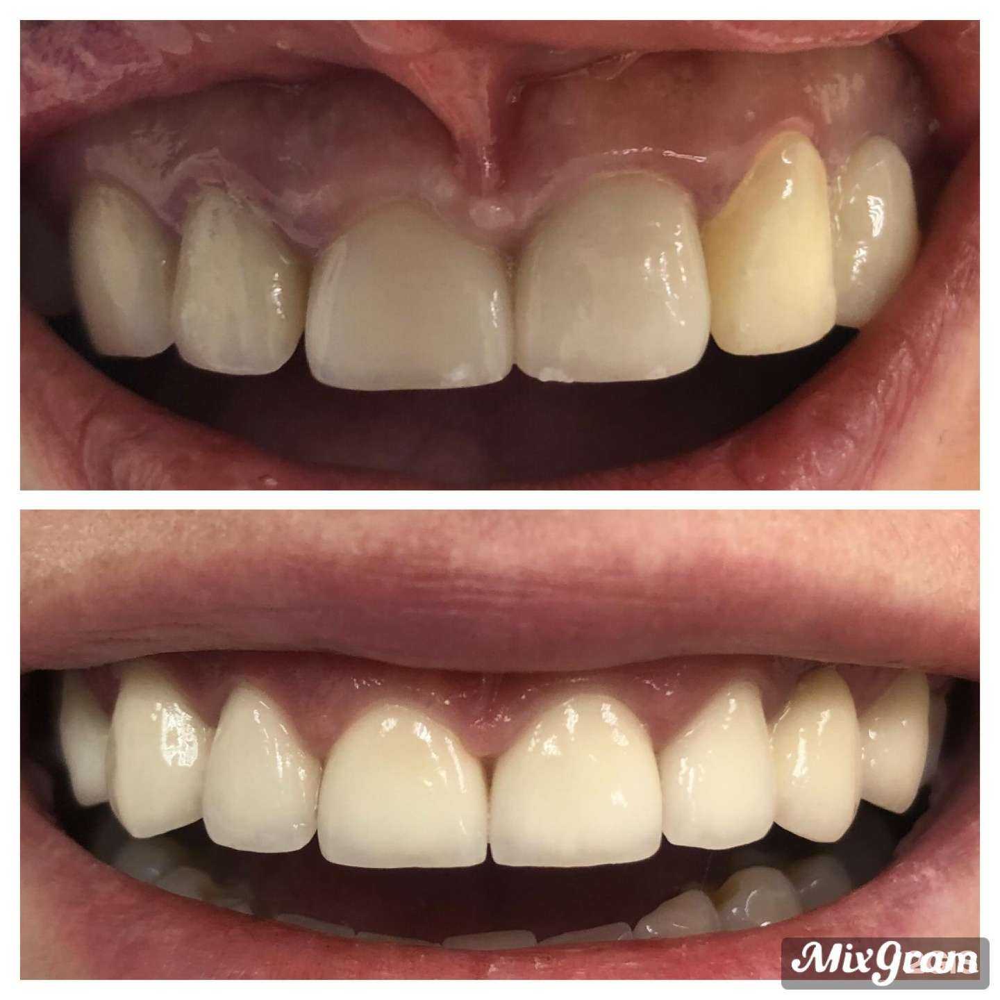 Отзывы на компанию Вип Дент в г. Новосибирск c фото